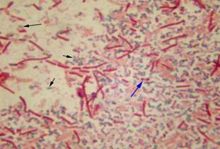 Endospore Stain